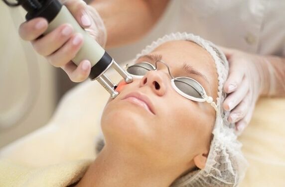 Thermal exposure to epidermis