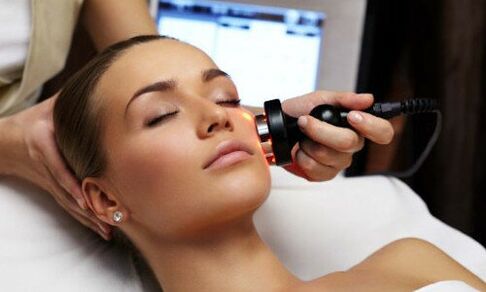 Laser rejuvenation of the face
